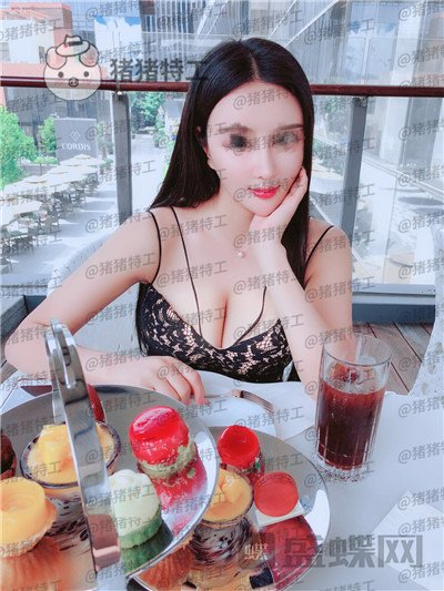 上海喜美,王会勇,隆鼻,鼻修复,案例,价格,