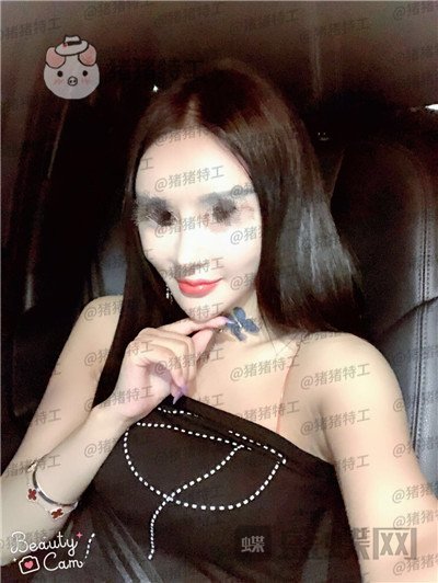 上海喜美,王会勇,隆鼻,鼻修复,案例,价格,