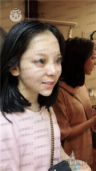 厦门福华,金贵香,鼻部手术,案例,价格,