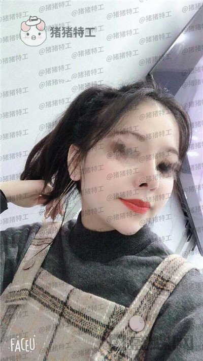 厦门福华,金贵香,鼻部手术,案例,价格,