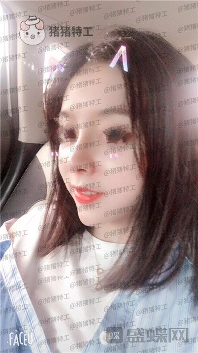 厦门福华,金贵香,鼻部手术,案例,价格,