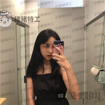 温州伯思立,倪锋,面部填充,案例,价格,