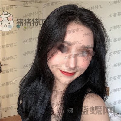 温州伯思立,倪锋,面部填充,案例,价格,