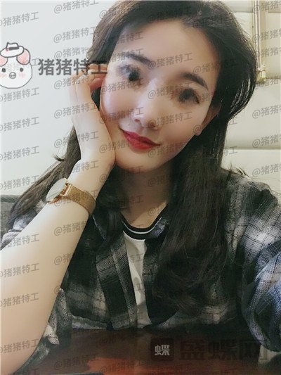 成都天使之翼,尤军,面部填充,案例,价格,