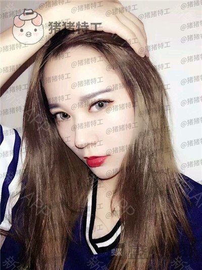 武汉华美,马行,鼻部手术,案例,价格,