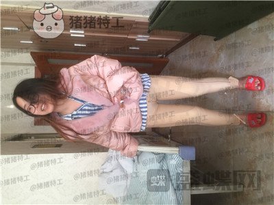 成都军大,蒲小兵,吸脂瘦腿,案例,价格,