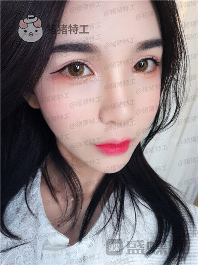 上海愉悦美联臣,荣峥,鼻部手术,案例,价格,