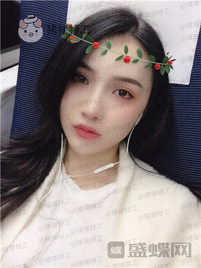上海愉悦美联臣,荣峥,鼻部手术,案例,价格,