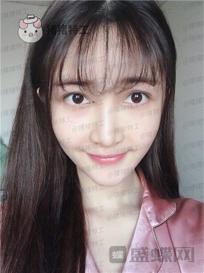 重庆天艺美,徐志强,面部填充,案例,价格,