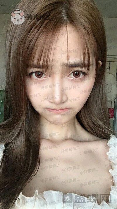 重庆天艺美,徐志强,面部填充,案例,价格,