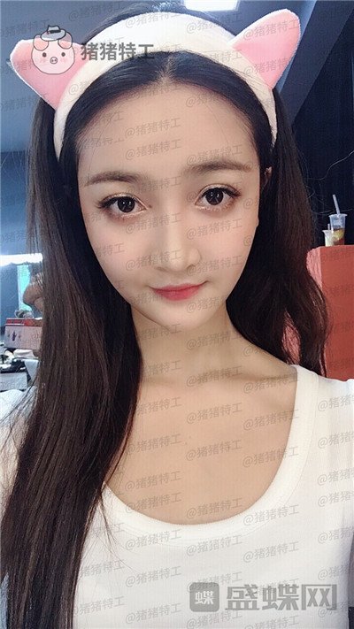 重庆天艺美,徐志强,面部填充,案例,价格,