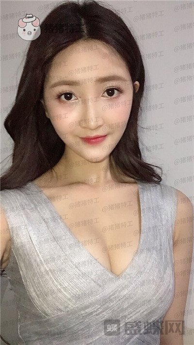 重庆天艺美,徐志强,面部填充,案例,价格,