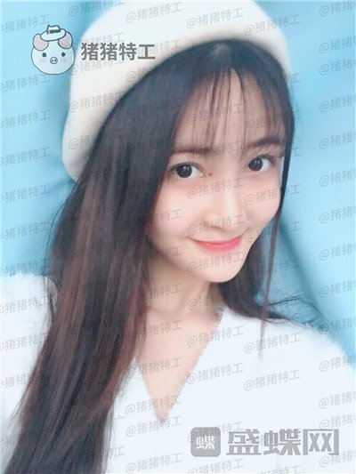 重庆天艺美,徐志强,面部填充,案例,价格,