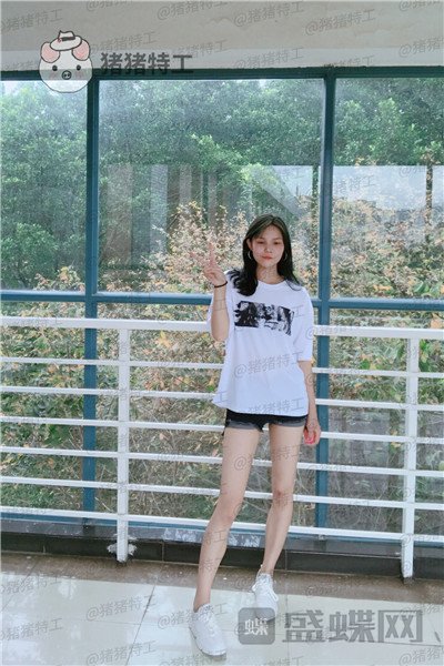 成都军大,成应龙,全身吸脂,案例,价格,