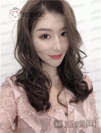 重庆中民整形科,孙刚,鼻部手术,案例,价格,