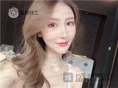重庆中民整形科,孙刚,鼻部手术,案例,价格,