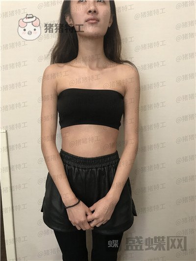 南京美贝尔,黄名斗,隆胸,案例,价格,