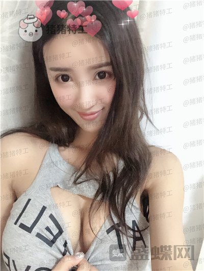 南京美贝尔,黄名斗,隆胸,案例,价格,