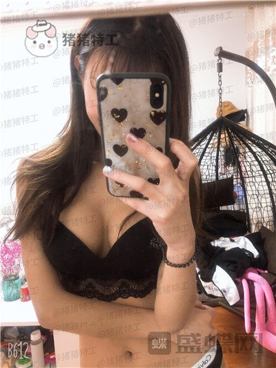 南京美贝尔,黄名斗,隆胸,案例,价格,