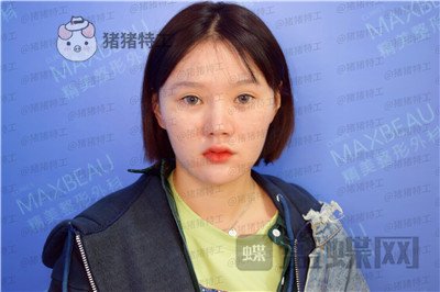 重庆精美,田永华,鼻部手术,案例,价格,