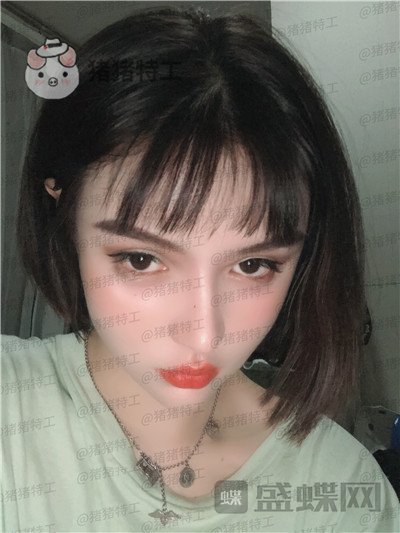 重庆精美,田永华,鼻部手术,案例,价格,