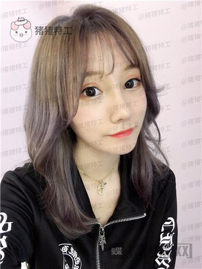 武汉希思特,陈安云,鼻部手术,案例,价格,