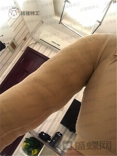 上海欧莱,,吸脂,案例,价格,
