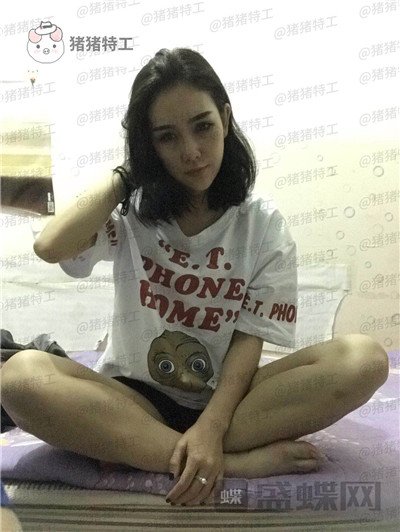上海欧莱,,吸脂,案例,价格,