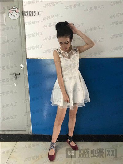 上海欧莱,,吸脂,案例,价格,