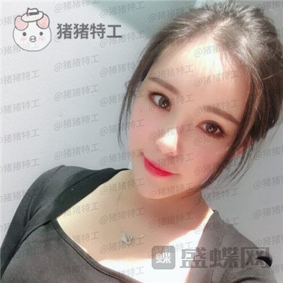 重庆百达丽,黄伟光,面部填充,案例,价格,