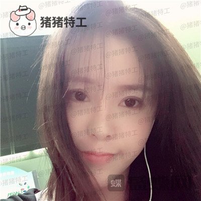 重庆百达丽,黄伟光,面部填充,案例,价格,