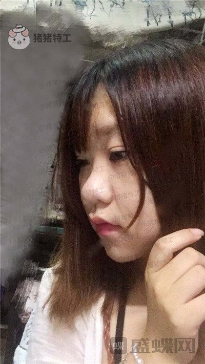 重庆玺悦台,蒋福明,面部吸脂,案例,价格,