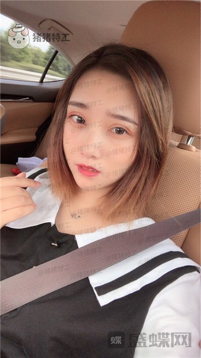 杭州格莱美,王馨婉,双眼皮,案例,价格,