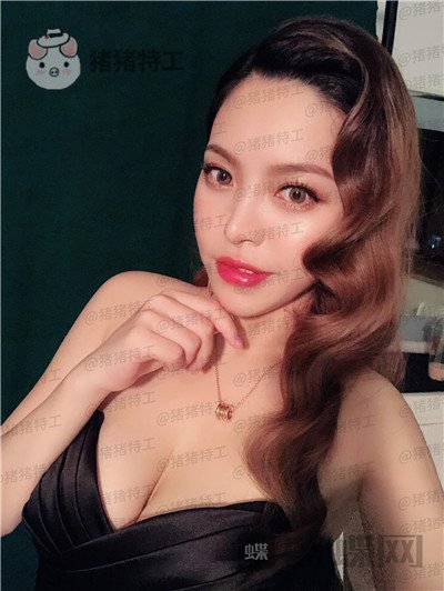 成都格莱丽,王伟,鼻部手术,案例,价格,