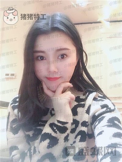 长沙凯莱,肖立卫,面部吸脂,案例,价格,