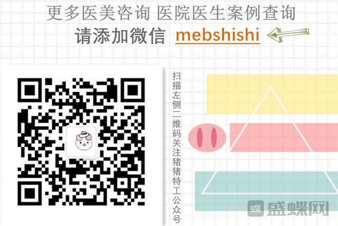 长沙凯莱,肖立卫,面部吸脂,案例,价格,