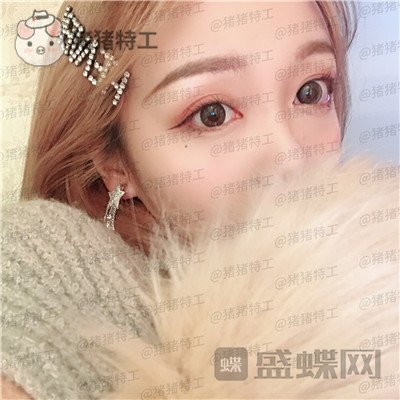 重庆铂生,郝荣涛,双眼皮,案例,价格,