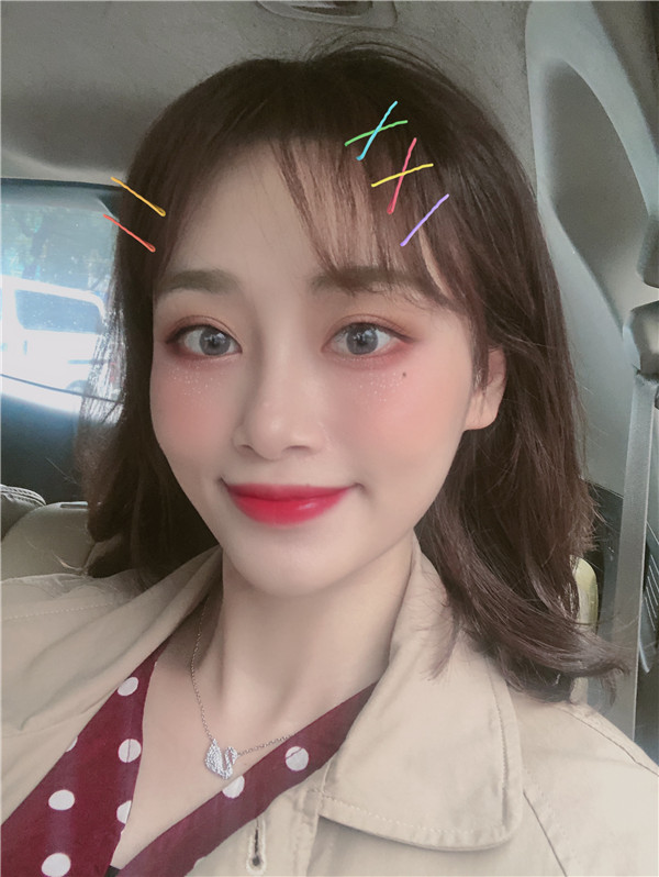 杭州艾尔莎奥拉克双眼皮怎么样?价格案例137天