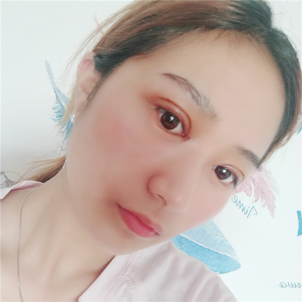 南京柠檬医疗双眼皮怎么样