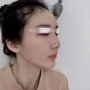 成都中医大银海何军眼部手术怎么样?