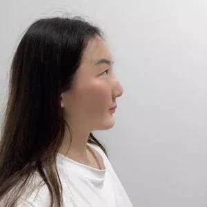 成都中医大银海何军眼部手术怎么样?