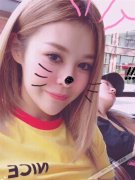 北京百达丽王维上海九院双眼皮修复,开眼角案例分享