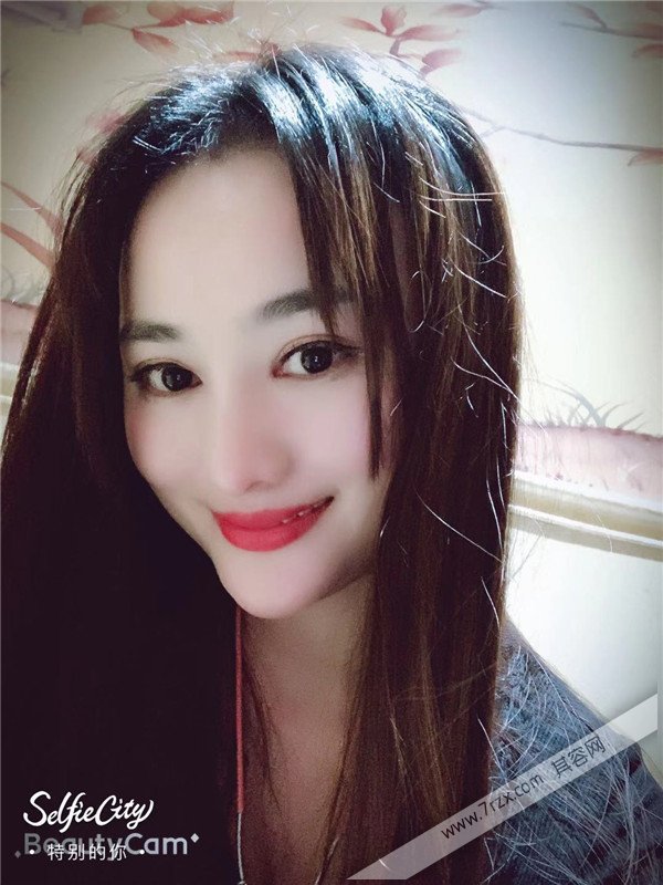 合肥壹美尚整形方蜜植发怎么样？价格案例