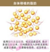 超小脂肪颗粒在面部年轻化的应用