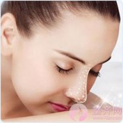 什么样的鼻子才好看？