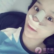 隆鼻修复手术改变了我的一生！