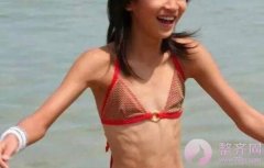 自体脂肪隆胸的基础知识