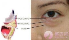 眼袋抽脂效果好吗?