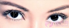 埋线双眼皮真的是“自然”的选择吗?