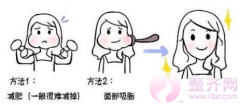 面部吸脂瘦脸效果